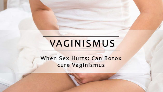 Vaginismus